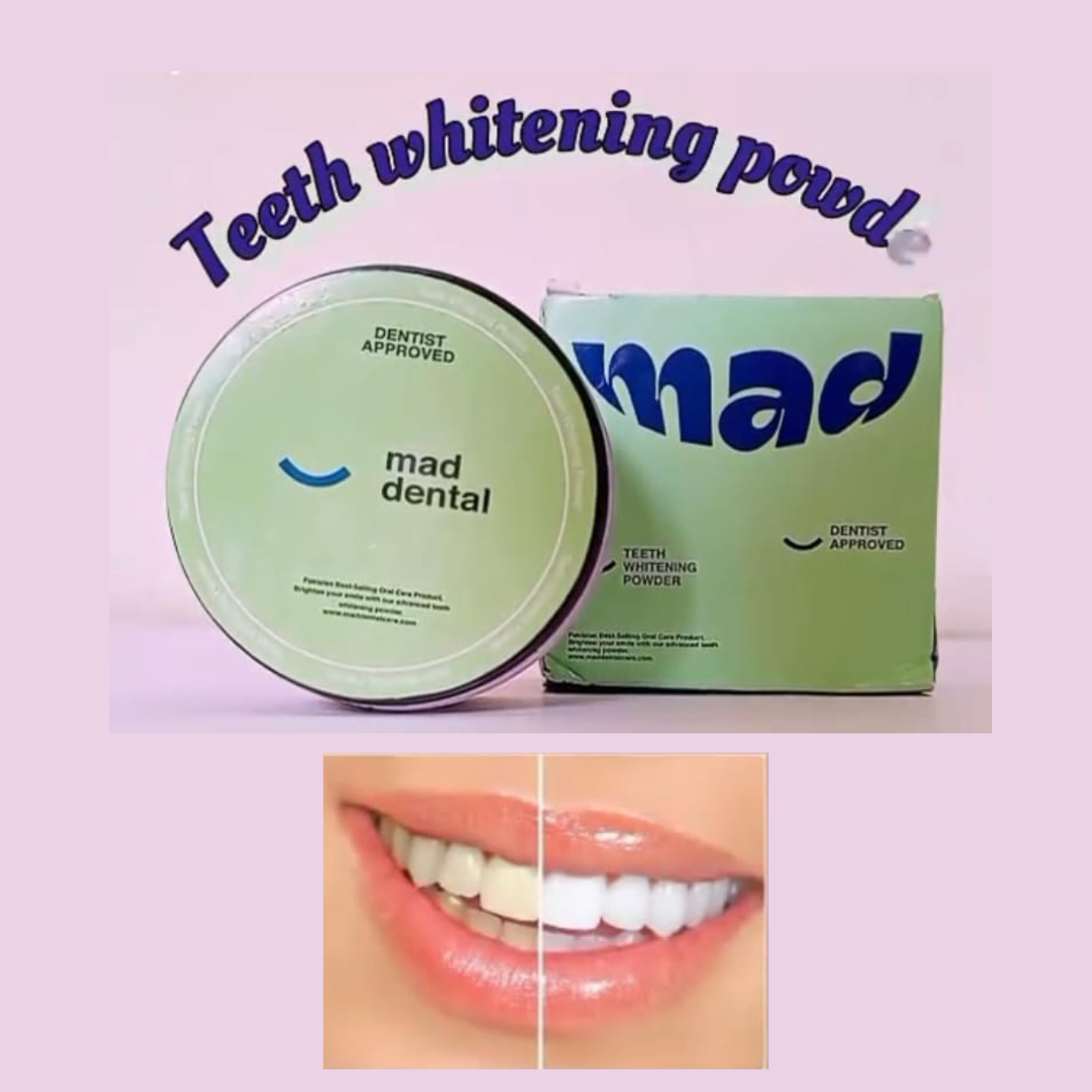 Mad Dental Care Powder  Whiter Teeth, Fresh Breath.